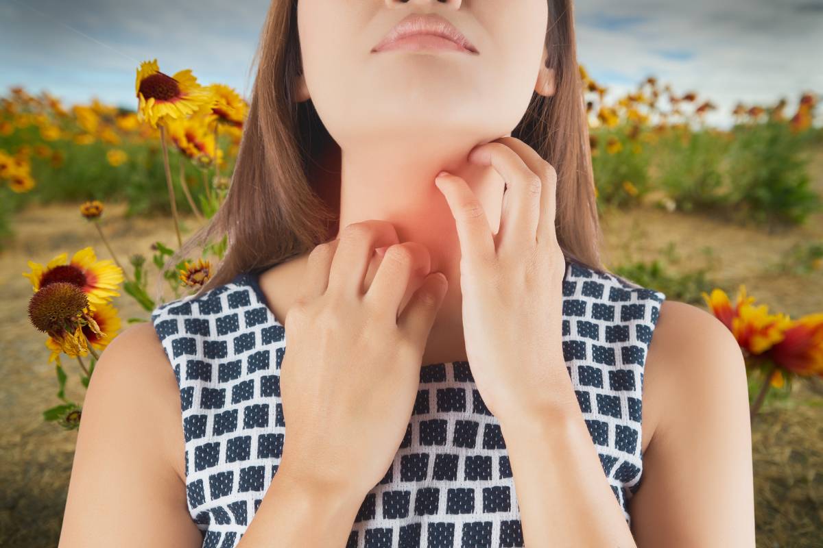 Do Blanket Flowers Make You Itch? Thriving Yard